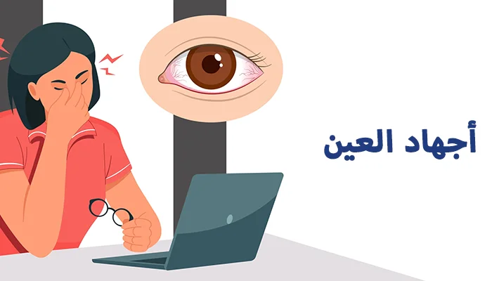 إجهاد العين - الأعراض، الأسباب والعلاج