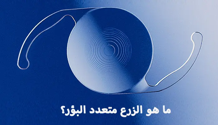 الزرع متعدد البؤر