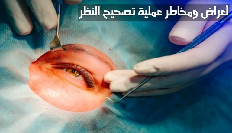 أعراض ومخاطر عمليات تصحيح النظر في الرياض