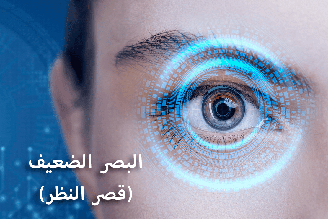 ضعف البصر