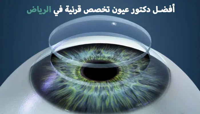 أفضل دكتور عيون تخصص قرنية في الرياض