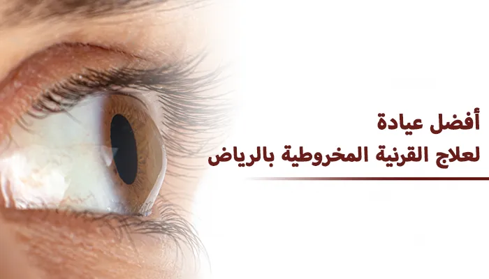 أفضل عيادة لعلاج القرنية المخروطية بالرياض