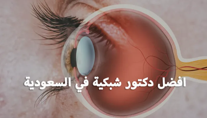 افضل دكتور شبكية في السعودية