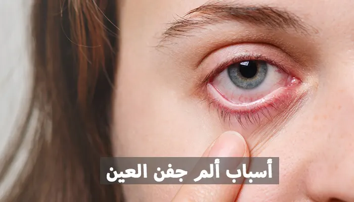 ألم جفن العين: أسبابه، طرق علاجه، وكيفية الوقاية منه