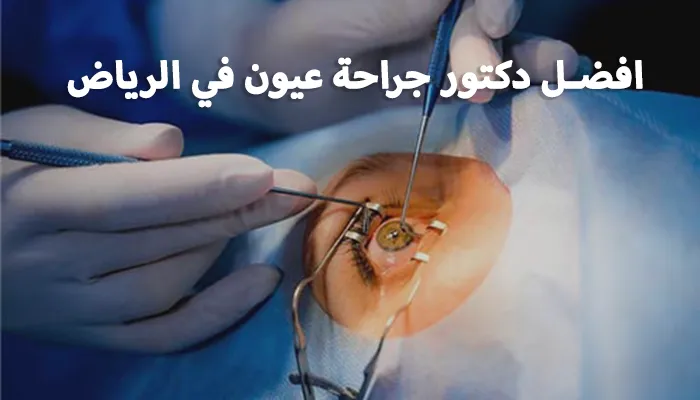 افضل دكتور جراحة عيون في الرياض