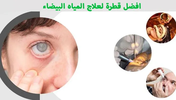 افضل قطرة لعلاج المياه البيضاء