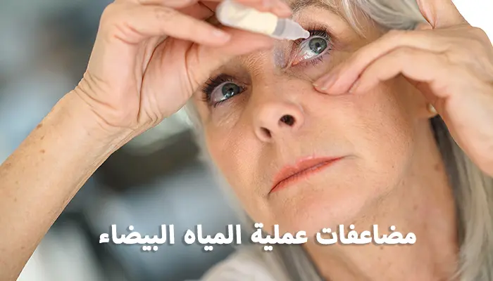 مضاعفات عملية المياه البيضاء ماذا بعد الجراحة؟