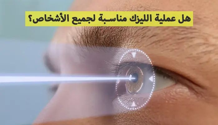 هل عملية الليزك مناسبة لجميع الأشخاص؟