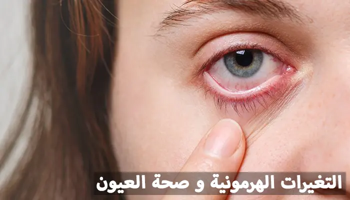 تعكس القوة العظيمة التي تتمتع بها النساء، تلك الكائنات القوية التي تعرف كيف تحافظ على تماسك الأمور حتى في أصعب الظروف. ورغم هذه القوة التي تتحلى بها المرأة، فإنها تواجه تحديات صحية متعددة، أبرزها المشاكل المتعلقة بصحة أعينهن.
أظهرت الأبحاث التي أُجريت على مدار العشرين عامًا الماضية أن النساء أكثر عرضة لخطر تعرضهن لتغيرات في الرؤية وتلف العين وفقدان البصر مقارنة بالرجال. حيث أظهرت الدراسات أن النساء هن أكثر عرضة بنسبة 12% لفقدان البصر مقارنة بالرجال.
رغم أن مشاكل الرؤية قد تصيب الجنسين، فإن النساء يعانين من تأثيرات أكبر وأوسع على بصرهن مقارنة بالرجال. فما هي الحلول المتاحة للنساء لمواجهة هذه التحديات؟
توجد العديد من العوامل البيولوجية التي تؤثر على صحة العين والرؤية لدى النساء، ومن هذه العوامل ما لا يمكنهن التحكم فيه. ولكن إدراك المخاطر والتوعية بها يمكن أن يساهم في اتخاذ خطوات وقائية للحفاظ على صحة العين وتحسين جودة الرؤية، مما يسهم في زيادة عدد النساء اللواتي يتمتعن بنظرة صحية وحادة.