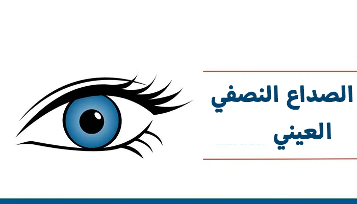 الصداع النصفي العيني: أسباب، أعراض، وطرق علاجه الفعّالة