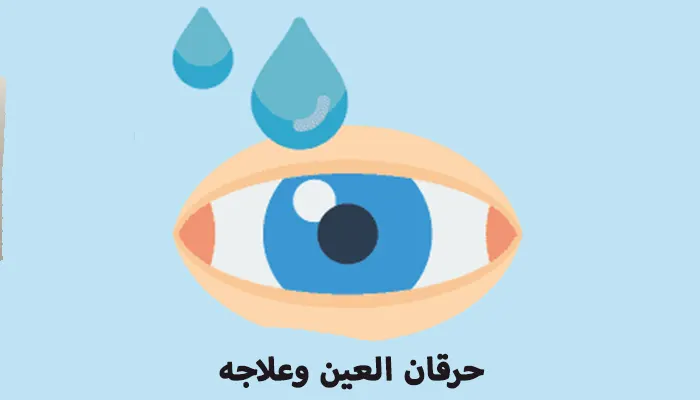 ما أسباب حرقان العين وكيفية علاجه؟