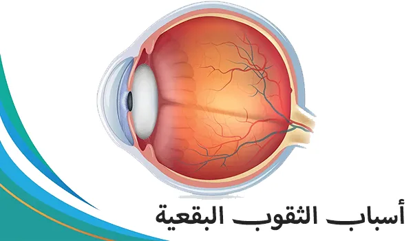 الثقوب البقعية: الأسباب والتطور والجراحة