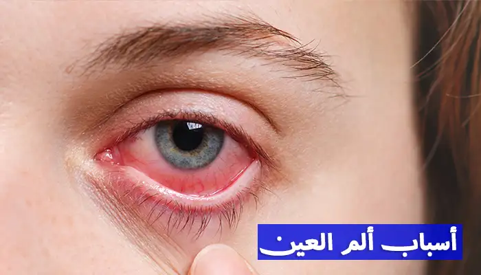 أسباب ألم العين داخل وحول العين وطرق العلاج