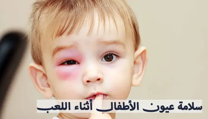 الألعاب وخطر إصابات العين عند الأطفال
