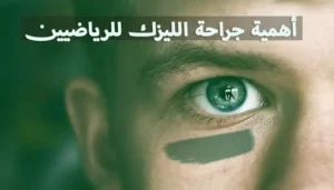 أهمية جراحة الليزك للرياضيين