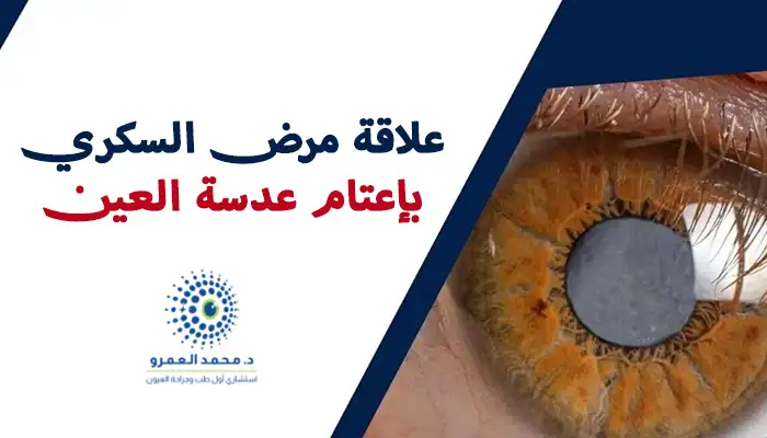 علاقة مرض السكري بإعتام عدسة العين