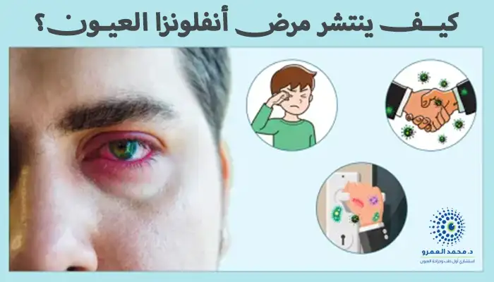 كيف ينتشر مرض أنفلونزا العيون؟