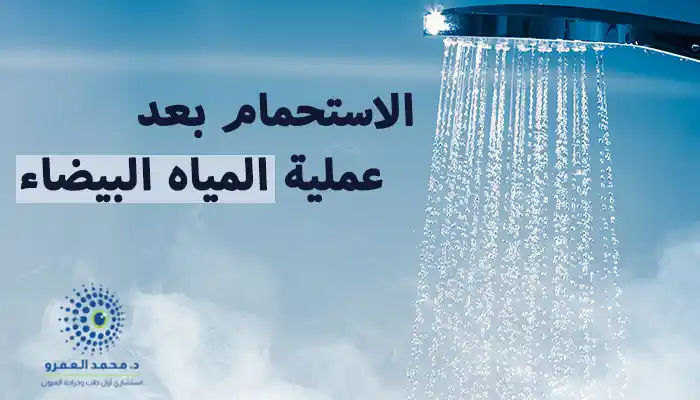 متى يمكن الاستحمام بعد عملية المياه البيضاء؟