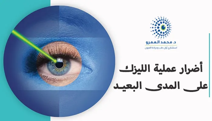 أضرار عملية الليزك على المدى البعيد