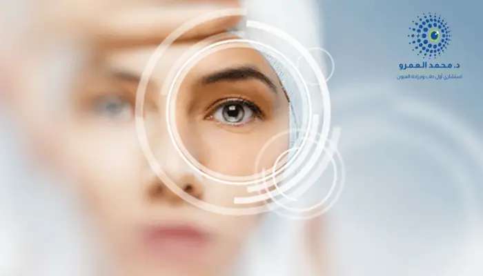 افضل مركز لعمليات تصحيح النظر بالرياض