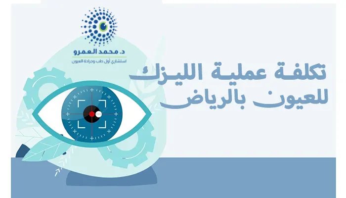 كم تكلفة عملية الليزك للعيون في الرياض؟