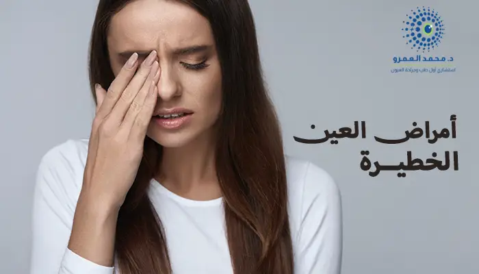 أبرز أمراض العين الخطيرة