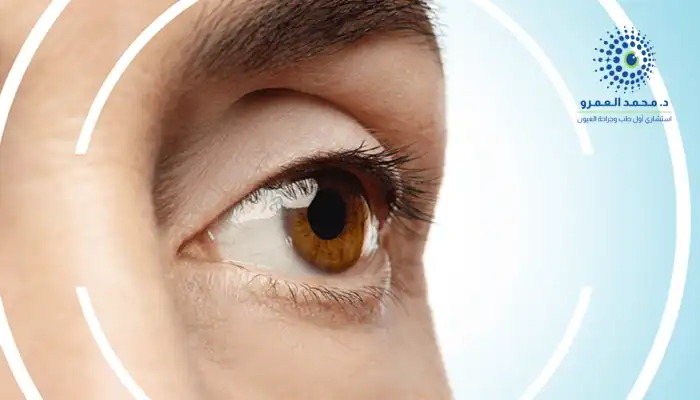 علاج القرنية المخروطية بالليزر في السعودية