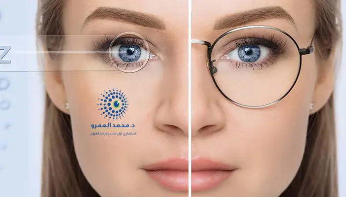 عمليات الليزر لإزالة النظارات الطبية