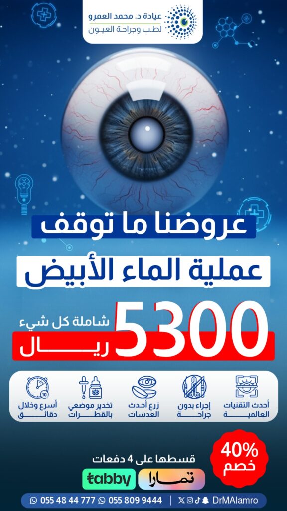 مويه بيضاء