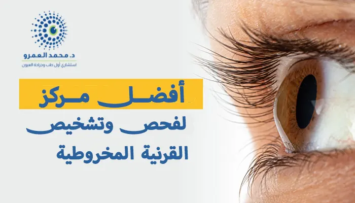 أفضل مركز لفحص وتشخيص القرنية المخروطية