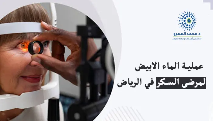 عملية الماء الابيض لمرضى السكر في الرياض
